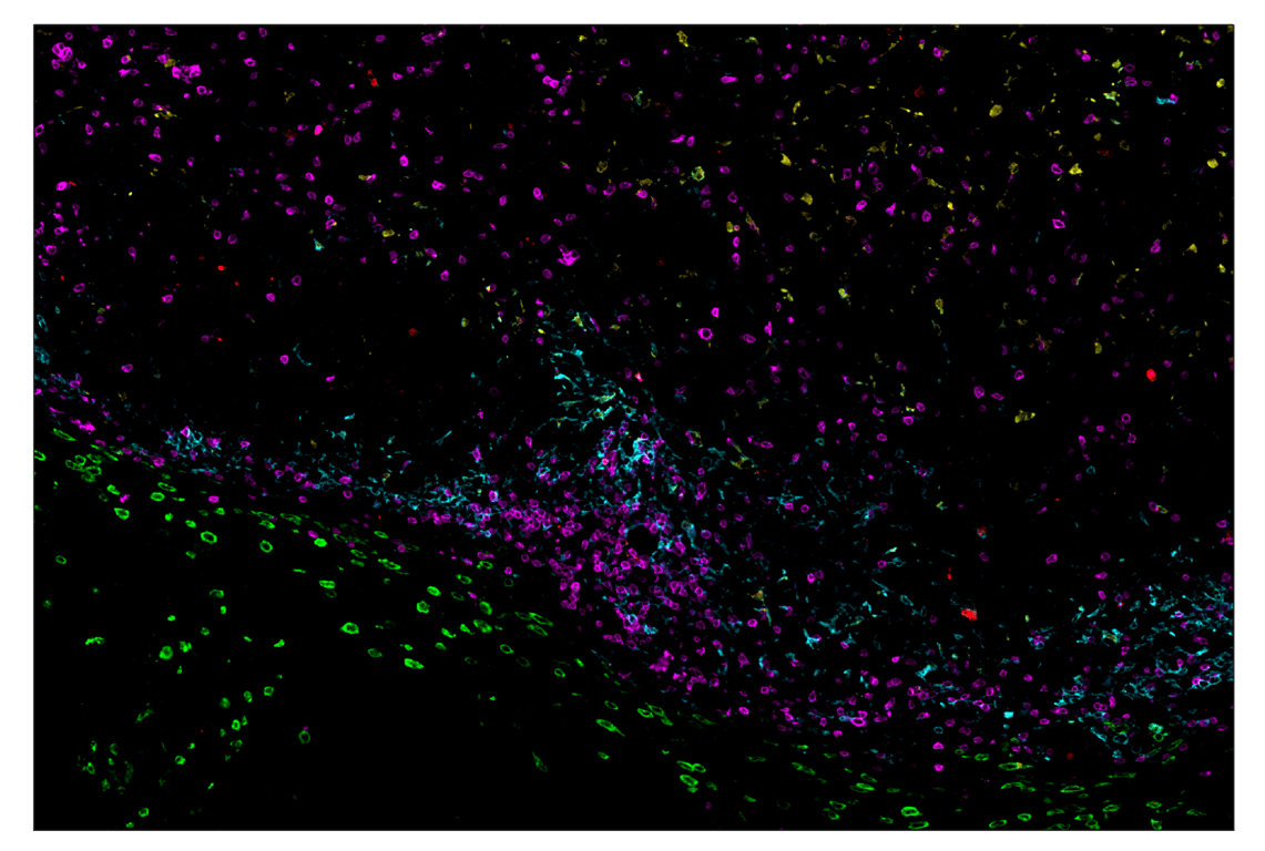 Immunohistochemistry Image 3: PD-L2 (D6L5A) & CO-0114-594 SignalStar<sup>™</sup> Oligo-Antibody Pair