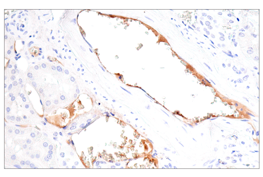 Immunohistochemistry Image 2: IGFBP3 (E6C2E) Rabbit Monoclonal Antibody