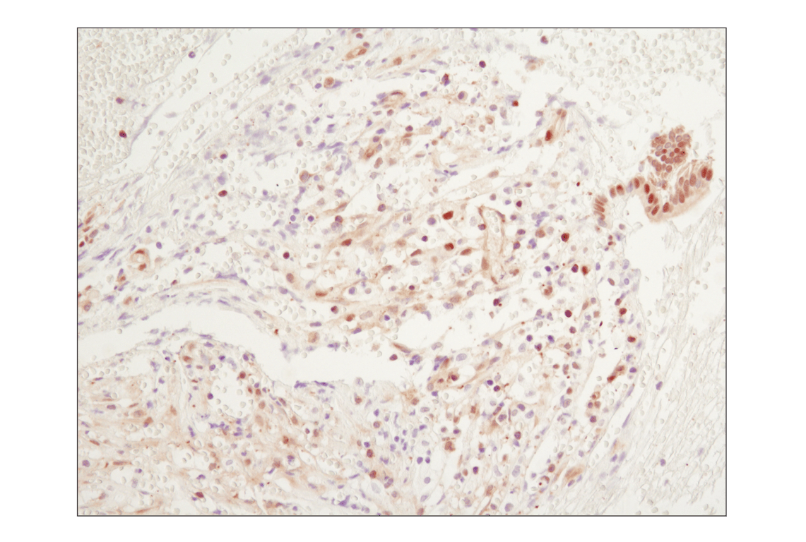 Immunohistochemistry Image 2: NF-kappaB p65 (D14E12) Rabbit Monoclonal Antibody