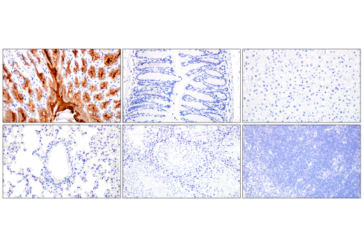 Immunohistochemistry Image 2: MUC5AC (E9V1O) Rabbit Monoclonal Antibody (BSA and Azide Free)