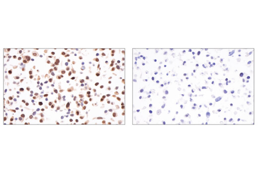 Immunohistochemistry Image 2: MGMT (E9O4V) Rabbit Monoclonal Antibody