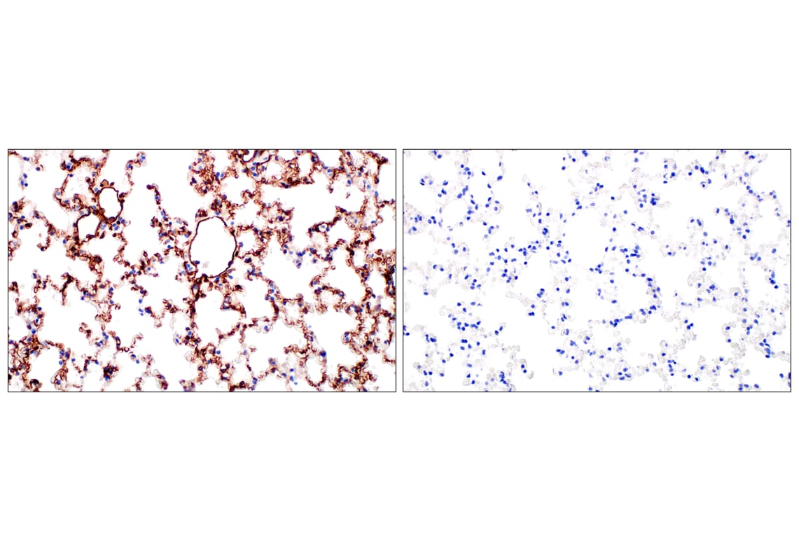 Immunohistochemistry Image 5: LYVE-1 (E5P8S) Rabbit Monoclonal Antibody