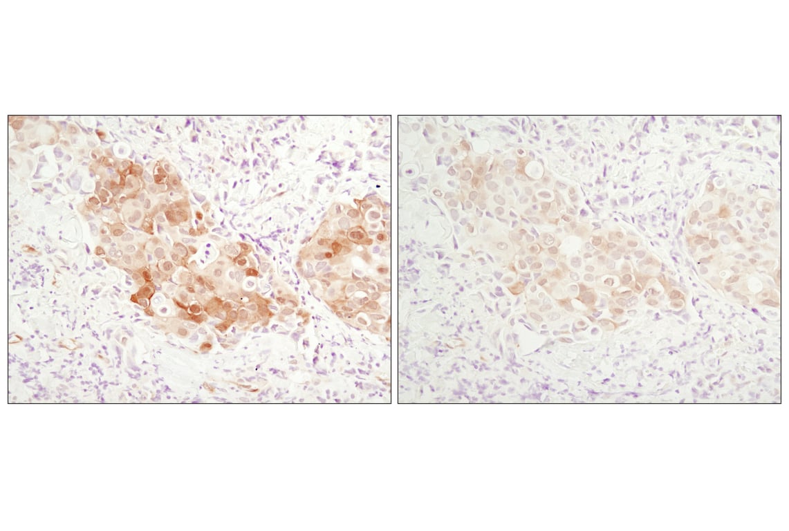 Immunohistochemistry Image 5: Phospho-Akt (Ser473) (D9E) XP<sup>®</sup> Rabbit mAb (BSA and Azide Free)