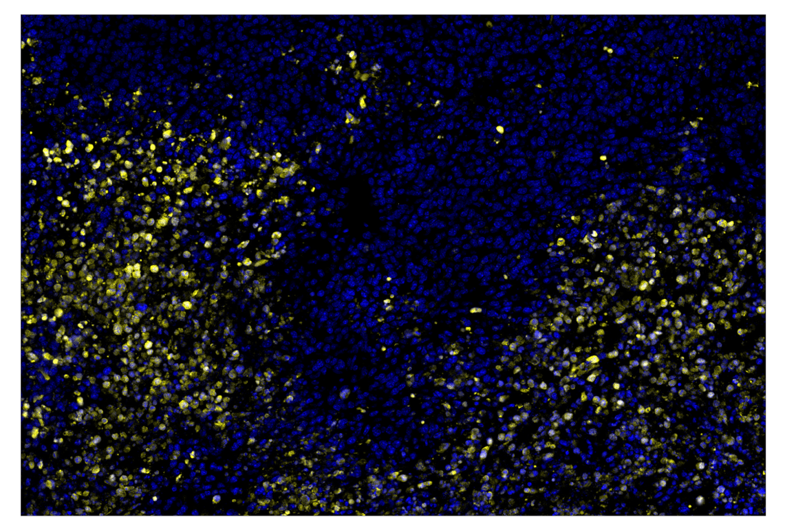 Immunohistochemistry Image 1: Cleaved PARP (Asp214) (D6X6X) & CO-0136-488 SignalStar<sup>™</sup> Oligo-Antibody Pair