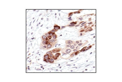 IκBα (L35A5) Mouse mAb (Amino-terminal Antigen) | Cell