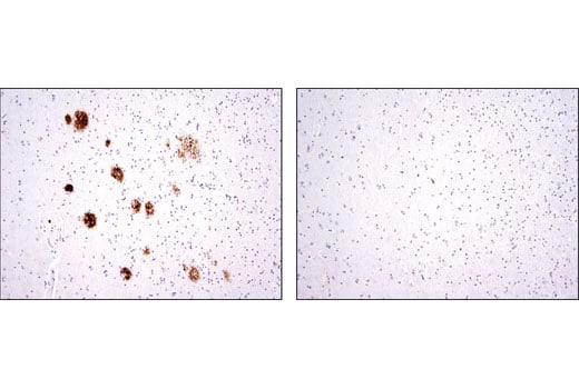 Immunohistochemistry Image 1: beta-Amyloid (D12B2) Rabbit Monoclonal Antibody