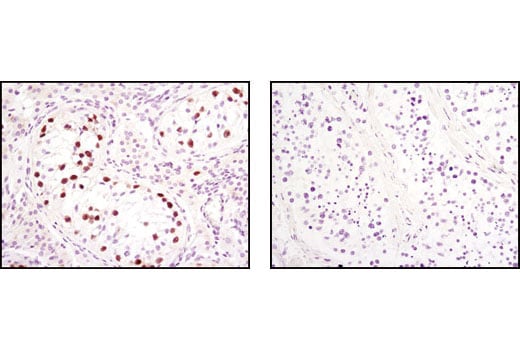 Immunohistochemistry Image 1: Oct-4 Antibody