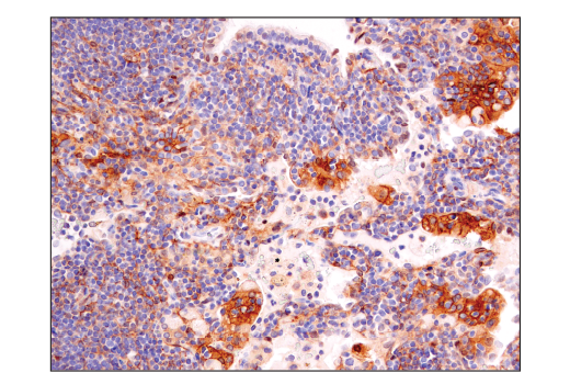 Immunohistochemistry Image 5: Notch2 (D76A6) Rabbit Monoclonal Antibody (BSA and Azide Free)