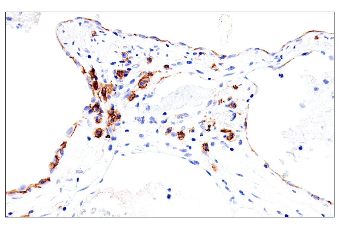 Immunohistochemistry Image 5: Syndecan 1 (E7F7T) Rabbit Monoclonal Antibody (BSA and Azide Free)
