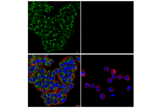 Immunofluorescence Image 1: TMEM106B (E7H7Z) Rabbit Monoclonal Antibody