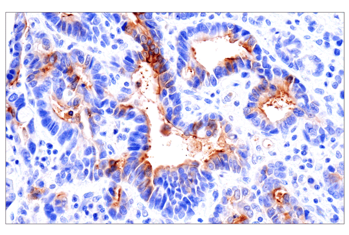 Immunohistochemistry Image 2: CEACAM7 (E5Q6X) Rabbit Monoclonal Antibody (BSA and Azide Free)