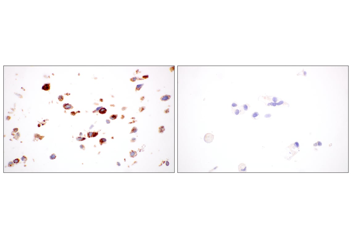 Immunohistochemistry Image 12: NPC1 (E7S4N) Rabbit Monoclonal Antibody