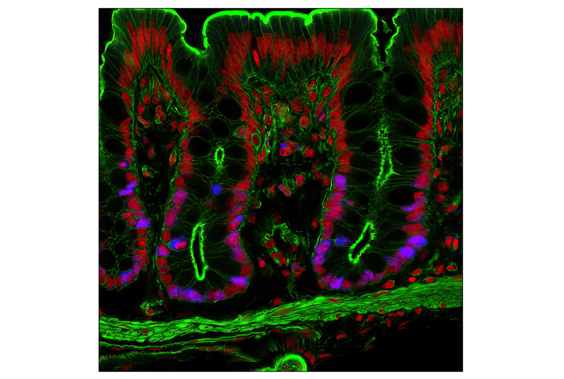Immunofluorescence Image 1: Ki-67 (D3B5) Rabbit Monoclonal Antibody (Alexa Fluor<sup>®</sup> 647 Conjugate)
