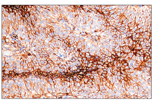 Immunohistochemistry Image 1: CD141/Thrombomodulin (E7Y9P) Rabbit Monoclonal Antibody