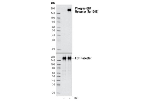 Western Blotting Image 1: EGF Receptor Control Cell Extracts