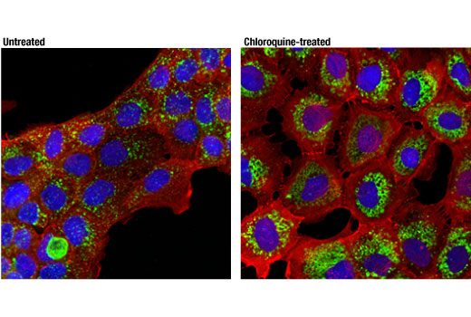 Immunofluorescence Image 1: LAMP1 (D4O1S) Mouse Monoclonal Antibody (BSA and Azide Free)