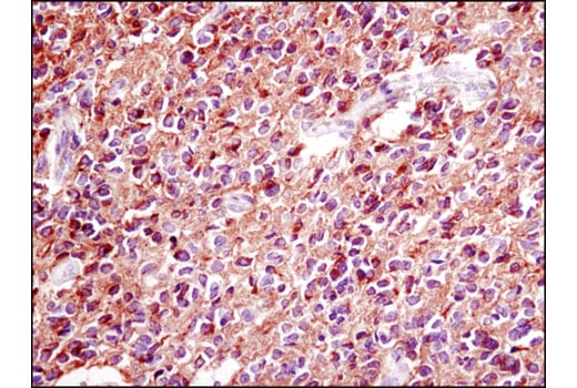 Immunohistochemistry Image 1: PDGF Receptor alpha (D13C6) Rabbit Monoclonal Antibody