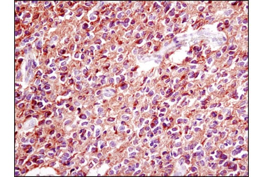 Immunohistochemistry Image 1: PDGF Receptor α (D13C6) XP<sup>®</sup> Rabbit mAb