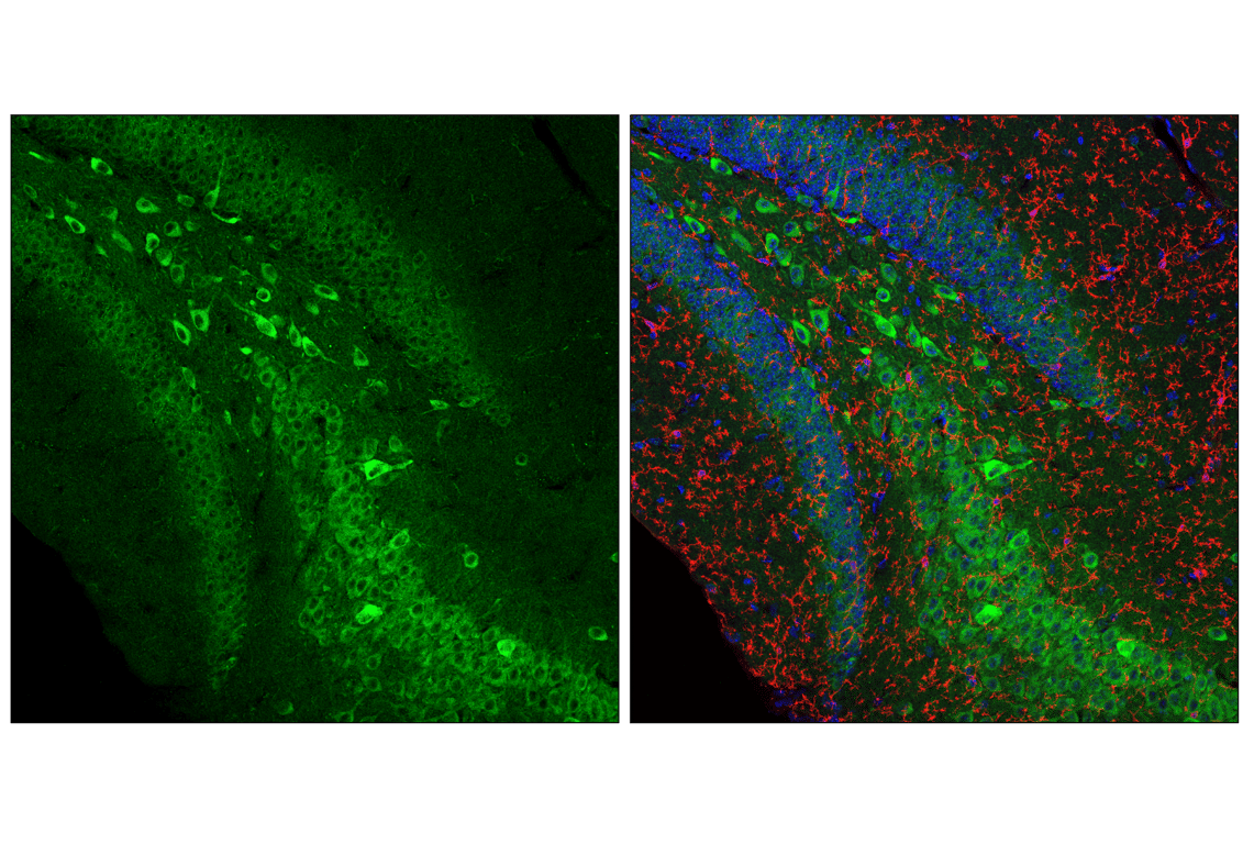 Immunofluorescence Image 1: VAPB (E7R3Z) Rabbit Monoclonal Antibody