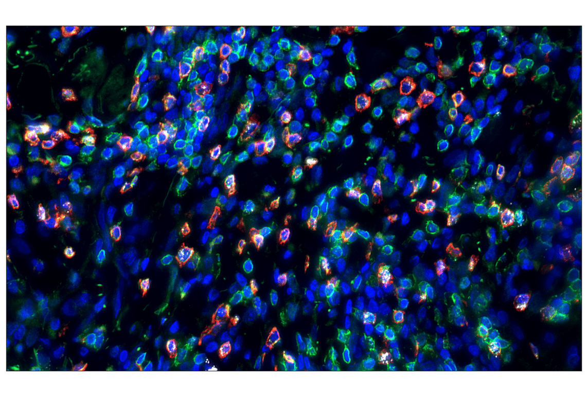 Immunohistochemistry Image 2: CD8 alpha (D8A8Y) Rabbit Monoclonal Antibody (Alexa Fluor<sup>®</sup> 555 Conjugate)