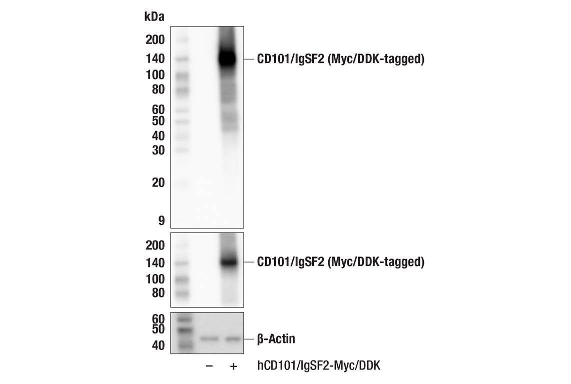 Western Blotting Image 2: CD101/IgSF2 (F6H5E) Rabbit Monoclonal Antibody