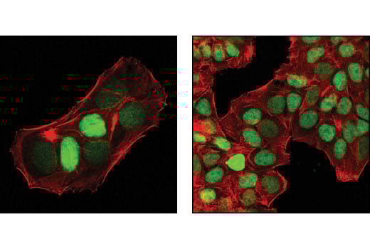 p27 Kip1 (D69C12) XP® Rabbit mAb | Cell Signaling Technology
