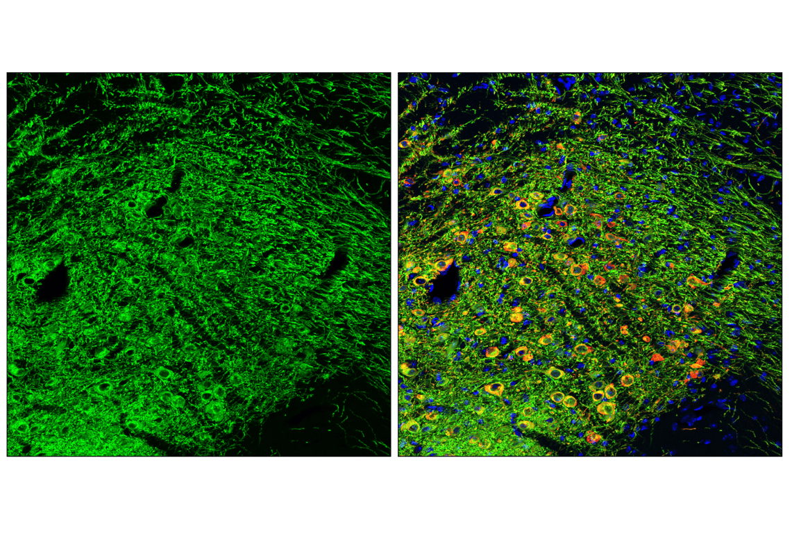 Immunofluorescence Image 2: Dopamine Transporter/DAT (E3U7R) Rabbit Monoclonal Antibody