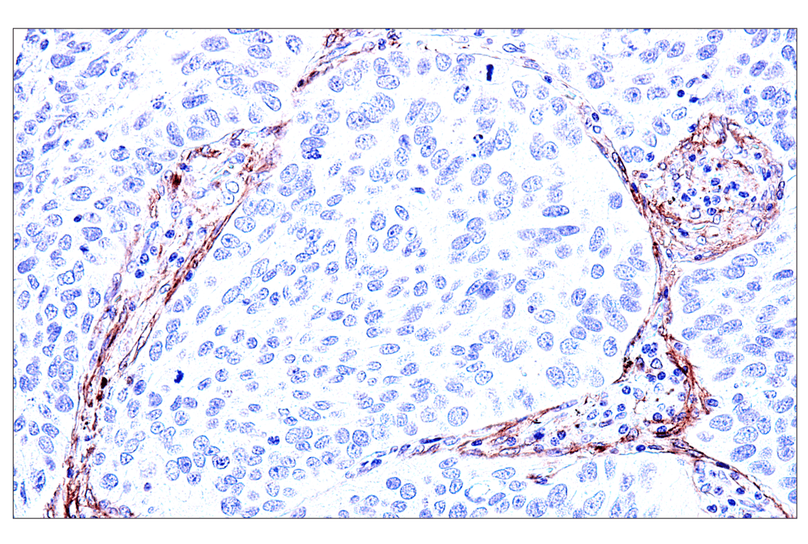 Immunohistochemistry Image 5: FAP (F1A4G) Rabbit Monoclonal Antibody
