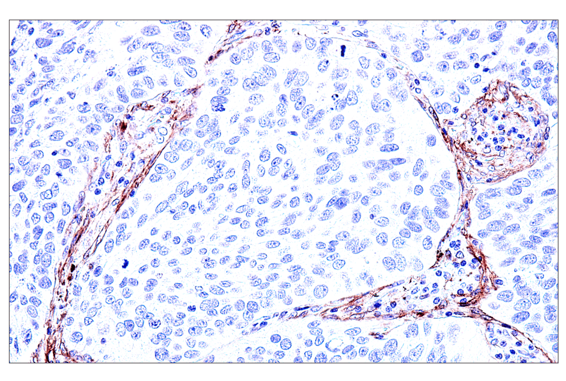 Immunohistochemistry Image 5: FAP (F1A4G) Rabbit mAb