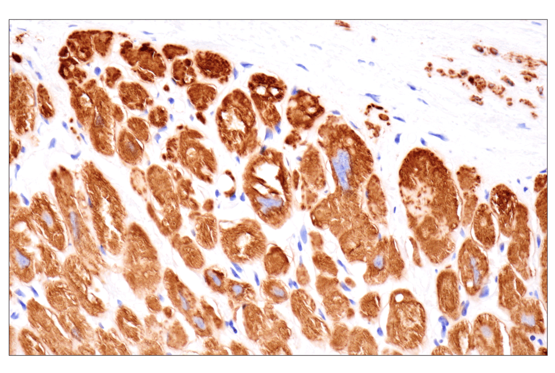 Immunohistochemistry Image 7: Desmin (F5V4I) Rabbit Monoclonal Antibody (BSA and Azide Free)