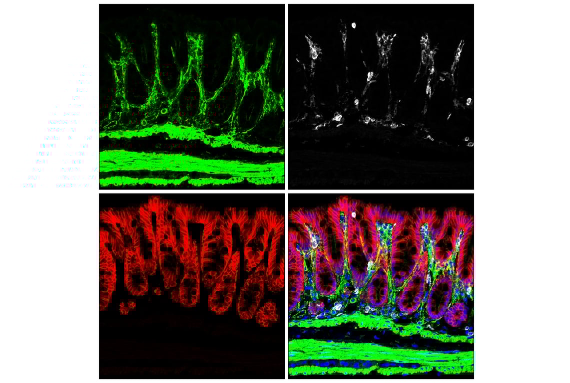 Immunofluorescence Image 1: Filamin A (E8P8M) Rabbit Monoclonal Antibody