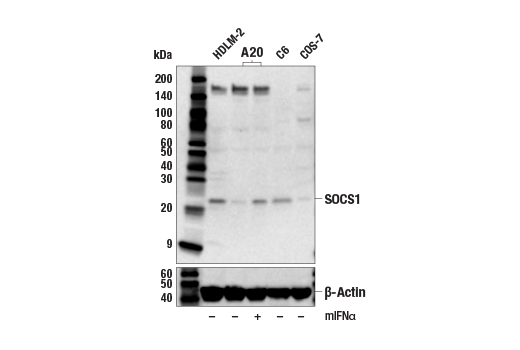Western Blotting Image 2: SOCS1 (E3Q4M) Rabbit Monoclonal Antibody