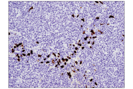 Immunohistochemistry Image 4: S100A9 (D5O6O) Rabbit Monoclonal Antibody (IHC Formulated)