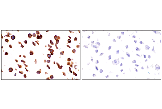 Immunohistochemistry Image 8: CEACAM6 (E7S7Y) Rabbit Monoclonal Antibody (BSA and Azide Free)