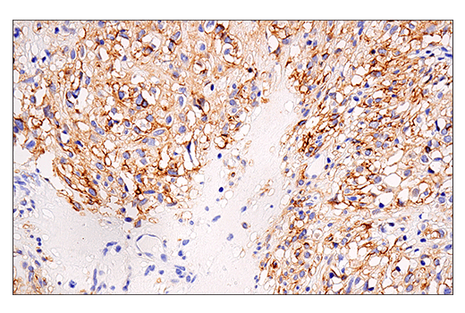 Immunohistochemistry Image 2: NCAM1 (CD56) (E7X9M) Rabbit Monoclonal Antibody (BSA and Azide Free)