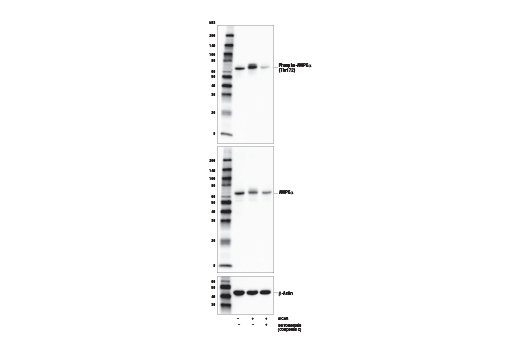 undefined Image 1: Dorsomorphin (Compound C)