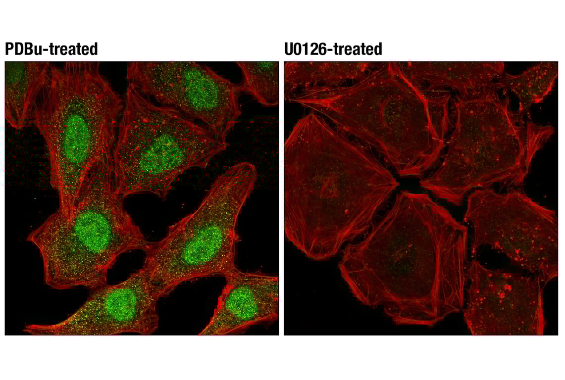 Immunofluorescence Image 1: Phospho-p44/42 MAPK (Erk1) (Tyr204)/(Erk2) (Tyr187) (D1H6G) Mouse Monoclonal Antibody