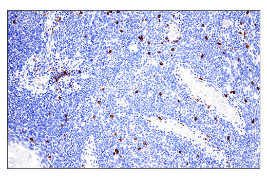 Immunohistochemistry Image 3: CD20 (E7B7T) Rabbit Monoclonal Antibody (BSA and Azide Free)