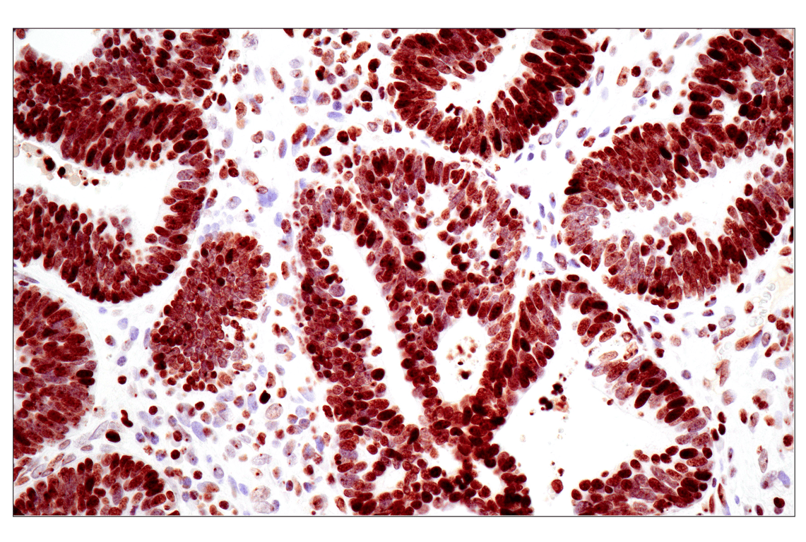 Immunohistochemistry Image 1: Tri-Methyl-Histone H3 (Lys27) (C36B11) Rabbit Monoclonal Antibody (BSA and Azide Free)