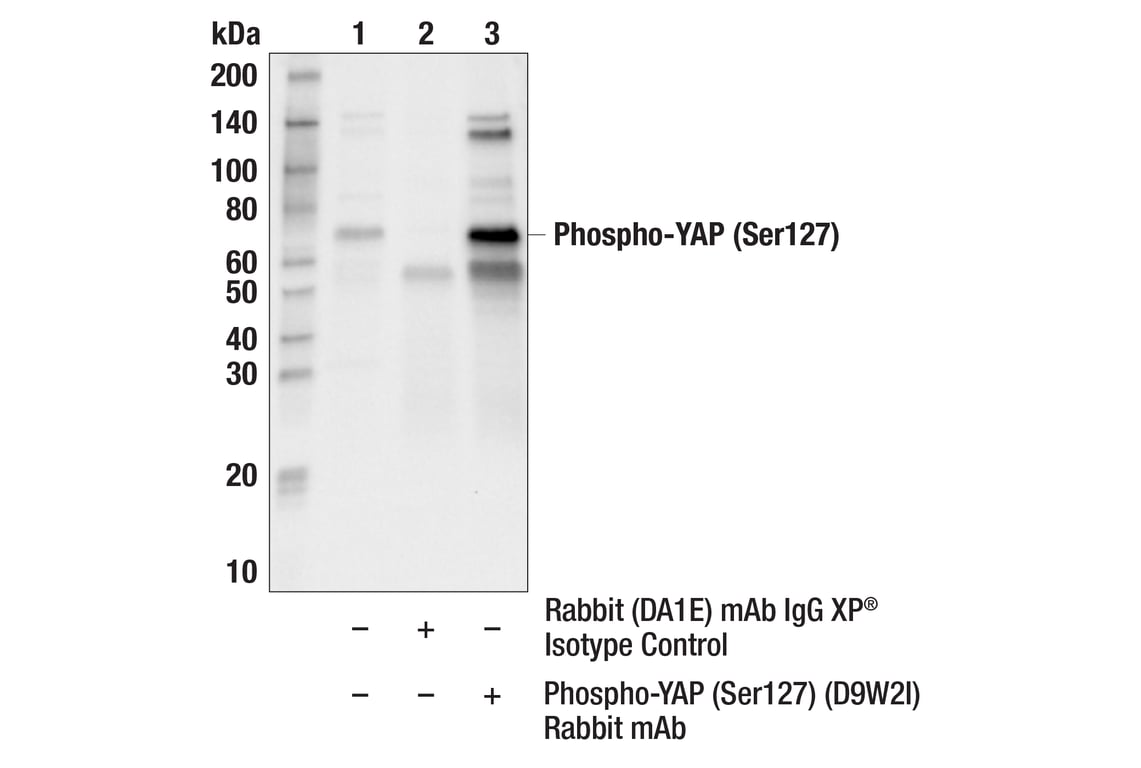 undefined Image 28: Hippo Signaling Antibody Sampler Kit
