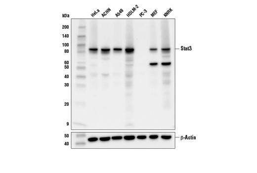 undefined Image 7: Stat Antibody Sampler Kit II