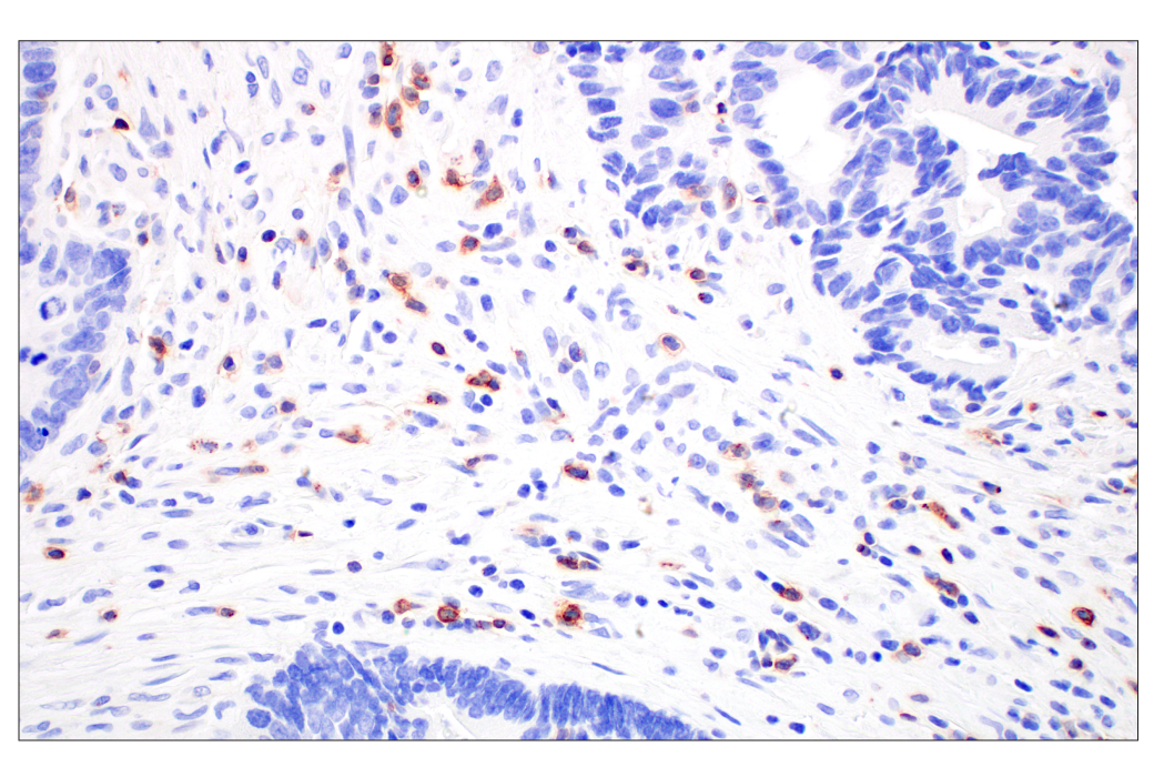 Immunohistochemistry Image 1: CD70 (E3Q1A) Rabbit Monoclonal Antibody