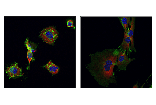 Immunofluorescence Image 2: NCAM1 (CD56) (E7X9M) Rabbit Monoclonal Antibody (BSA and Azide Free)