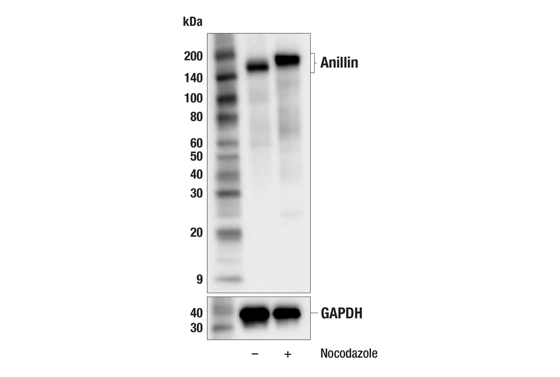 Western Blotting Image 2: Anillin (F6M2V) Rabbit Monoclonal Antibody