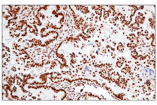 Immunohistochemistry Image 4: RPA32/RPA2 (E8X5P) Rabbit Monoclonal Antibody (BSA and Azide Free)