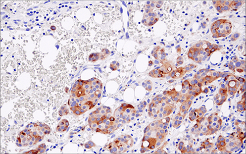 Immunohistochemical analysis of paraffin-embedded  spleen using FoxP3 (D6O8R) Rabbit mAb