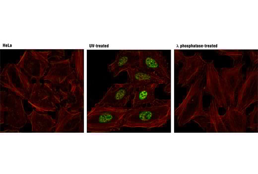 undefined Image 19: Phospho-Chk1/2 Antibody Sampler Kit