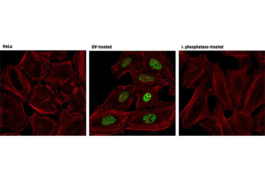 Immunofluorescence Image 1: Phospho-Chk1 (Ser317) (D12H3) XP<sup>®</sup> Rabbit mAb