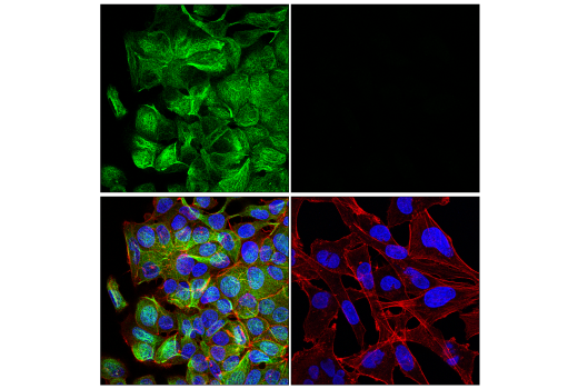Immunofluorescence Image 1: MAP7 (E8K7O) Rabbit Monoclonal Antibody