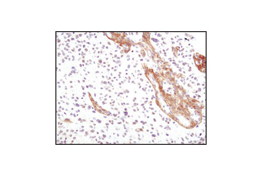Immunohistochemistry Image 1: PDGF Receptor alpha (D1E1E) Rabbit Monoclonal Antibody (BSA and Azide Free)